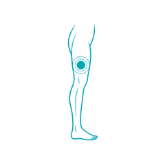 Leg